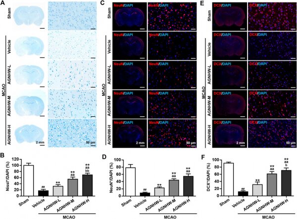 FIGURE 2. AGNHW pre-treatment restored neuronal loss in MCAO model 