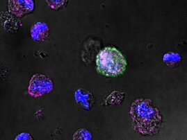 浸大研究揭示检验尿液中的人类巨细胞病毒能有效推算早期HIV-1患者罹患终端器官疾病之机率