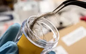 Hair analysis as a potential tool for early risk assessment of gestational hypothyroidism