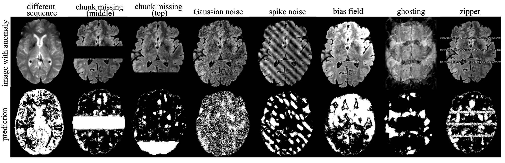 Figure 1: Visualisation of anomaly detection results on images with synthetic anomalies using our method IterMask3D. The first row shows the input images with simulated anomalies, while the second row displays the corresponding detected anomaly areas.